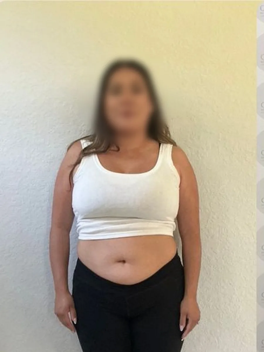 GoWell weight loss client, before – result 5