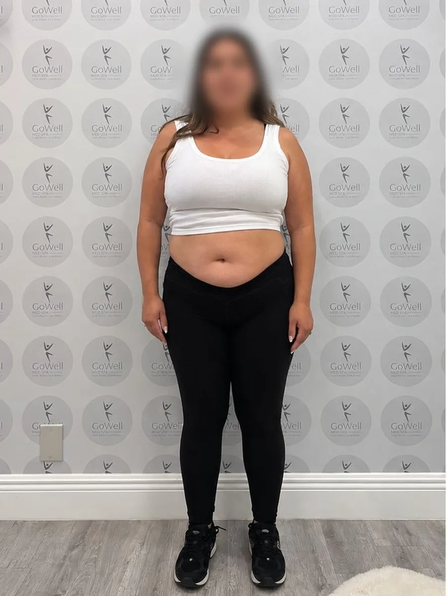GoWell weight loss client, before – result 10