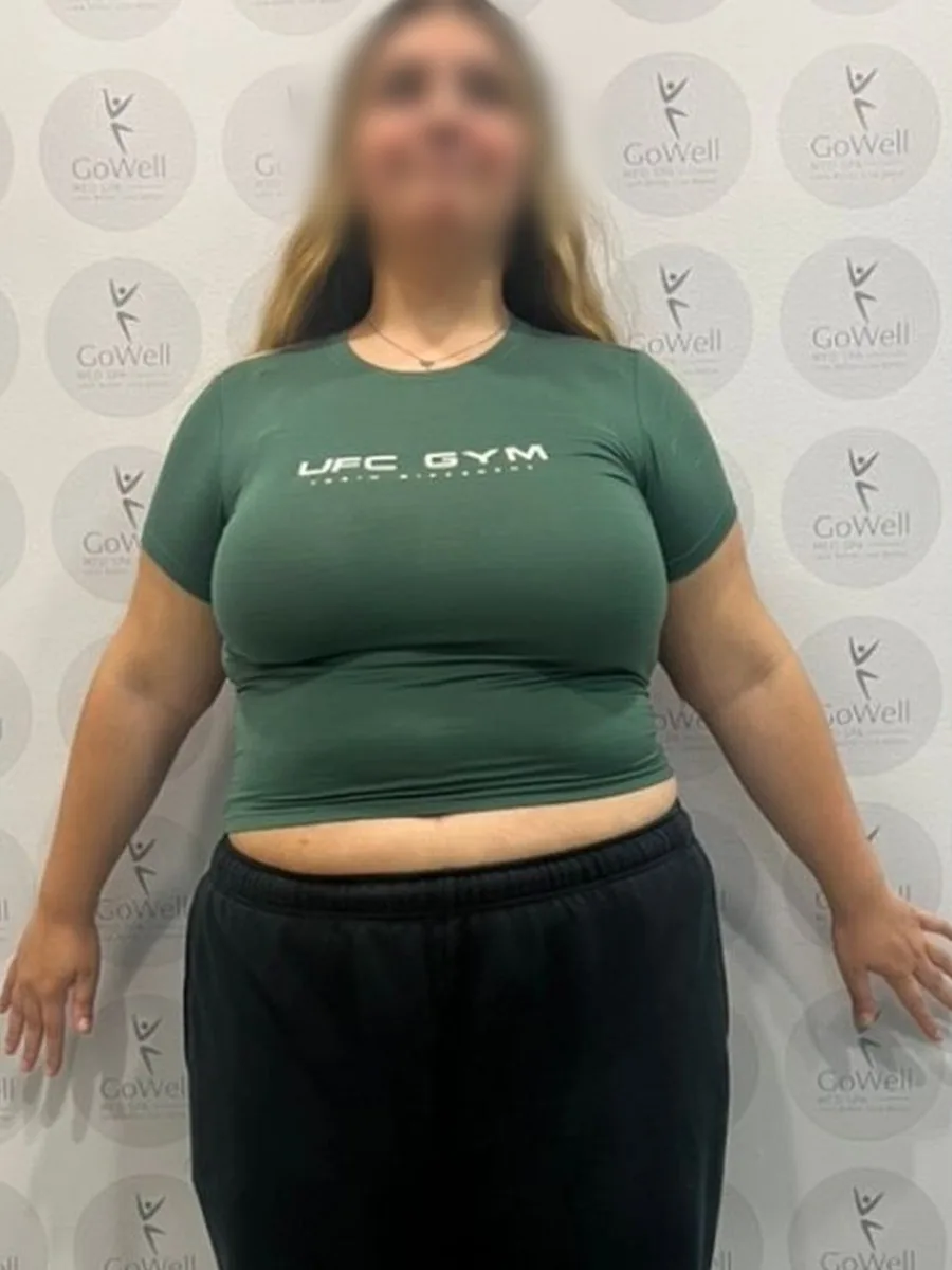 GoWell weight loss client, before – result 9