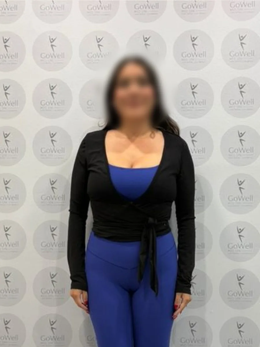 GoWell weight loss client, after – result 5