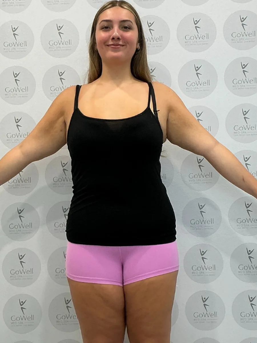 GoWell weight loss client, after – result 8