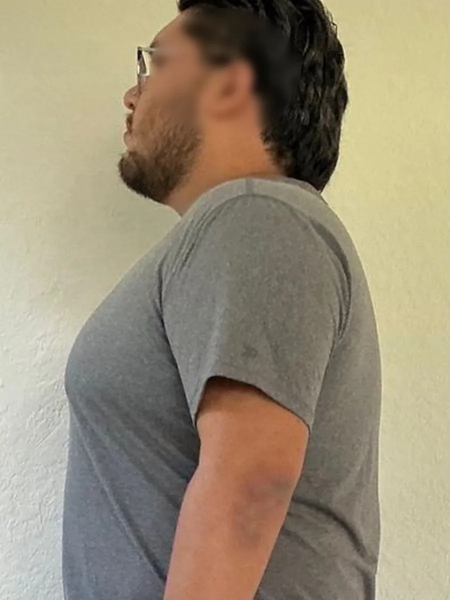 GoWell weight loss client, before – result 2