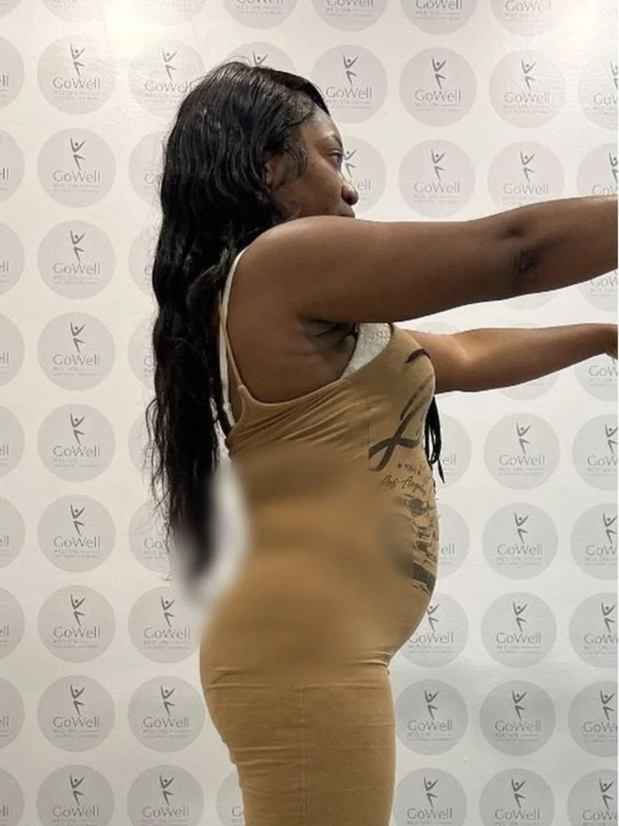 GoWell weight loss client, before – result 7