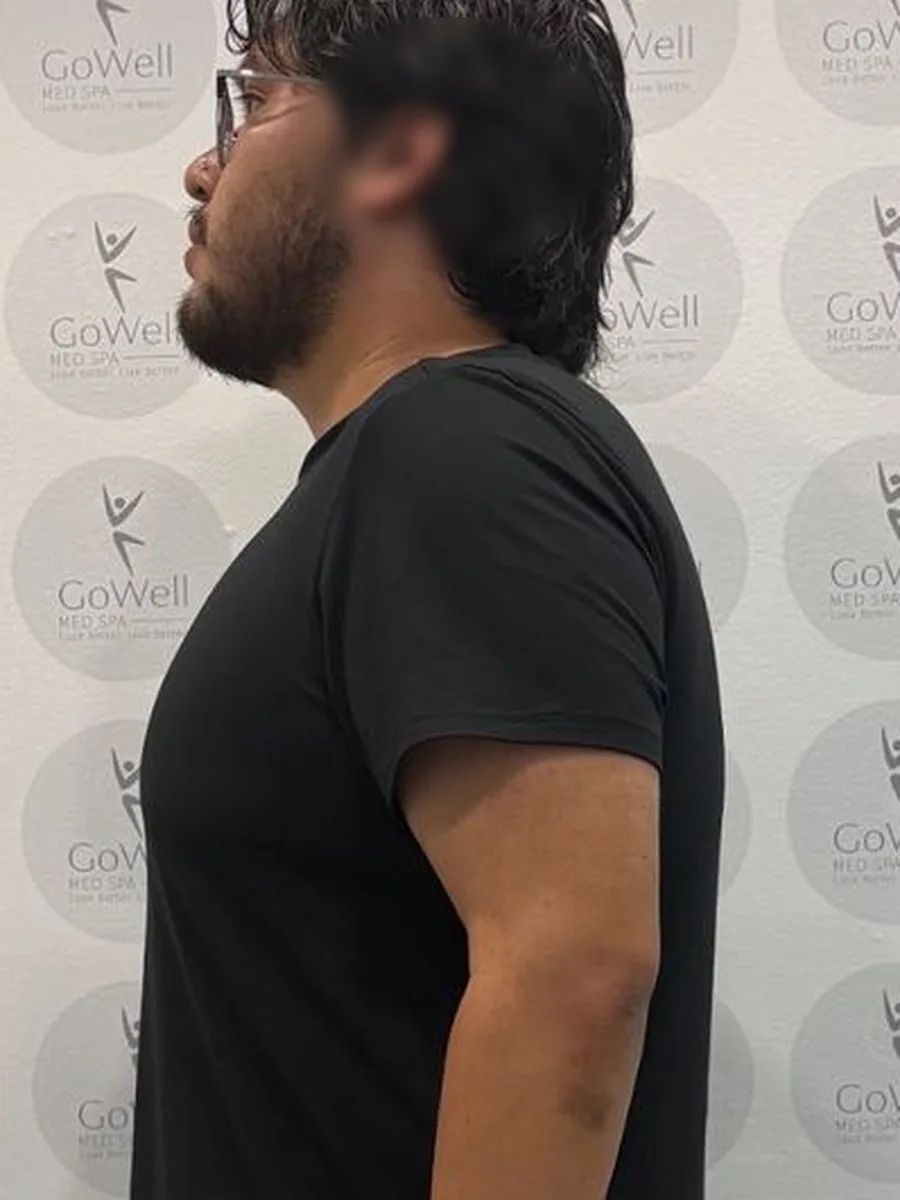 GoWell weight loss client, after – result 2
