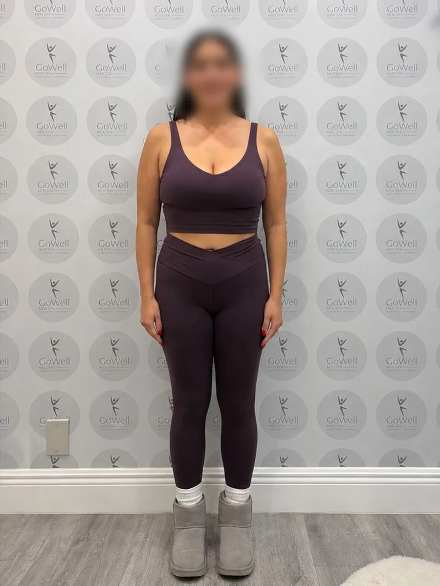 GoWell weight loss client, after – result 10