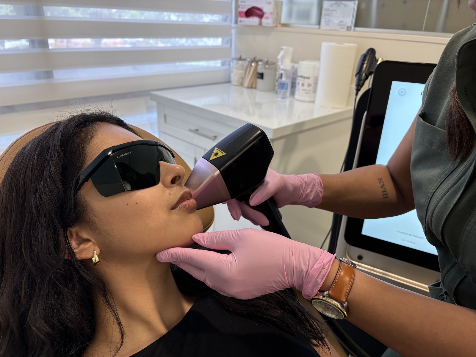 Close-up of a laser hair removal session on a client's face at GoWell Med Spa