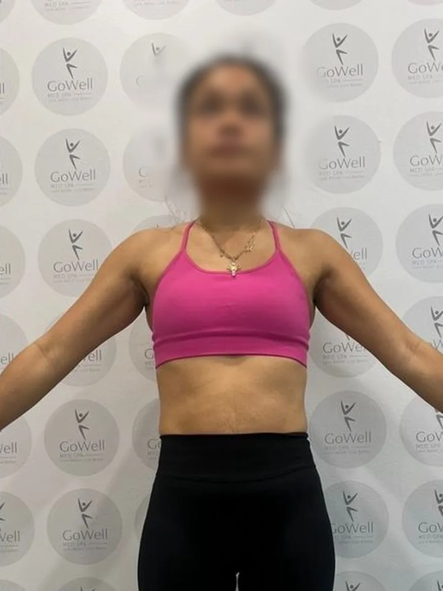 GoWell weight loss client, after – result 3