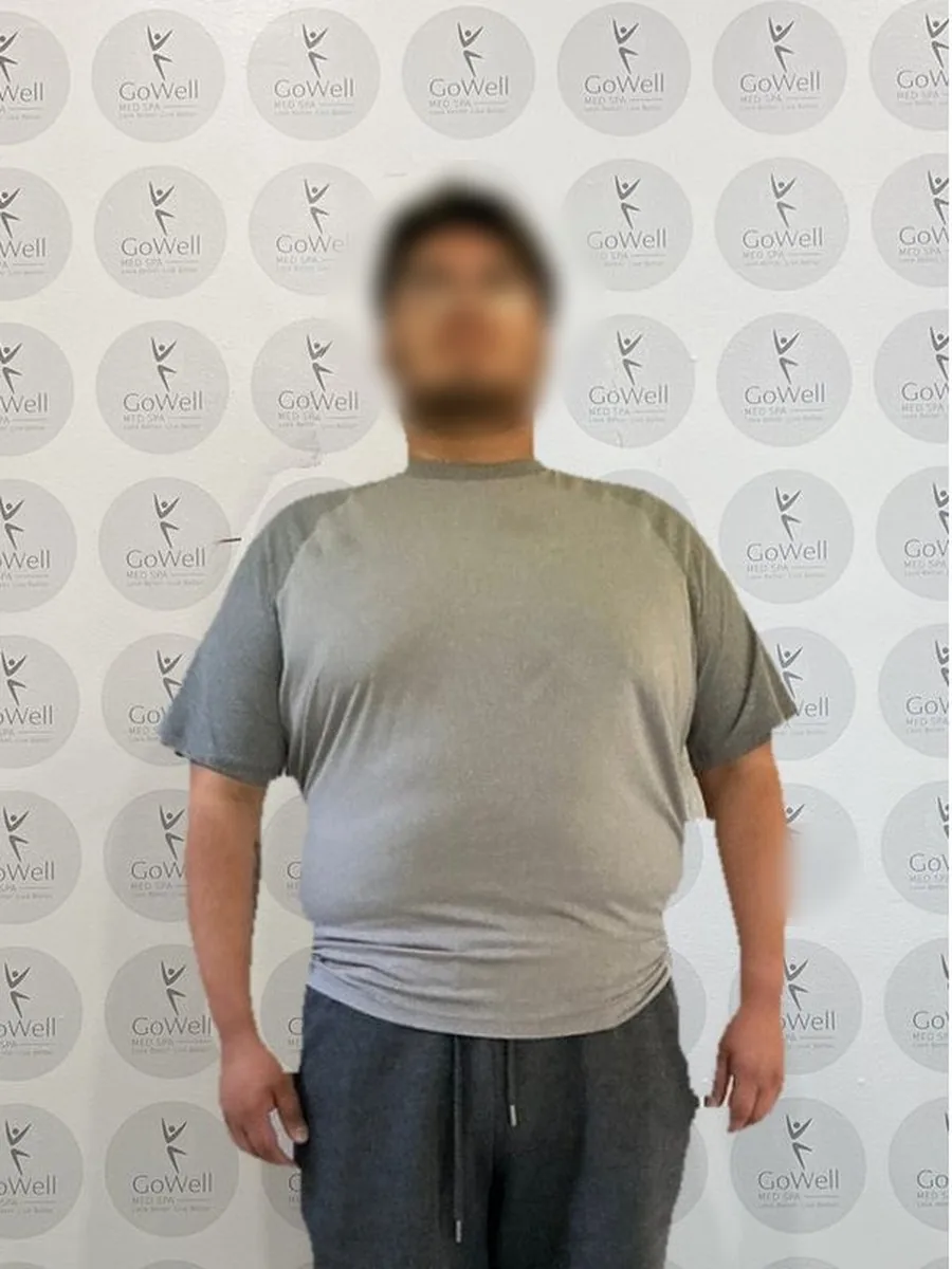 GoWell weight loss client, before – result 6