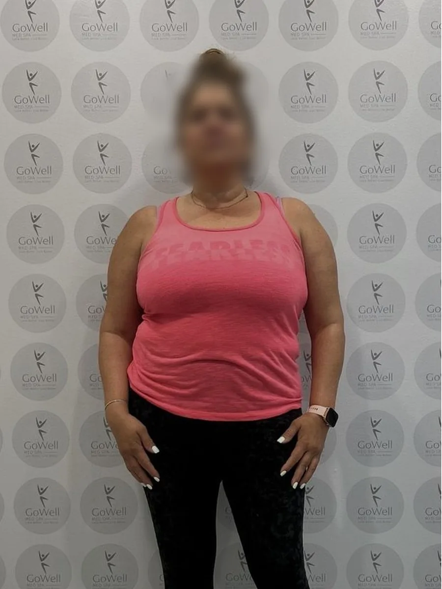 GoWell weight loss client, before – result 8