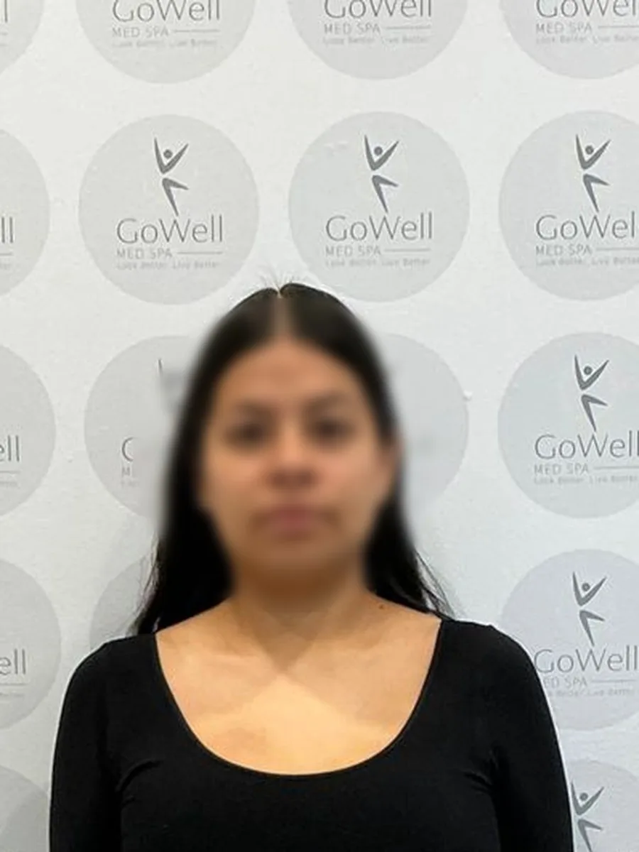 GoWell weight loss client, after – result 4