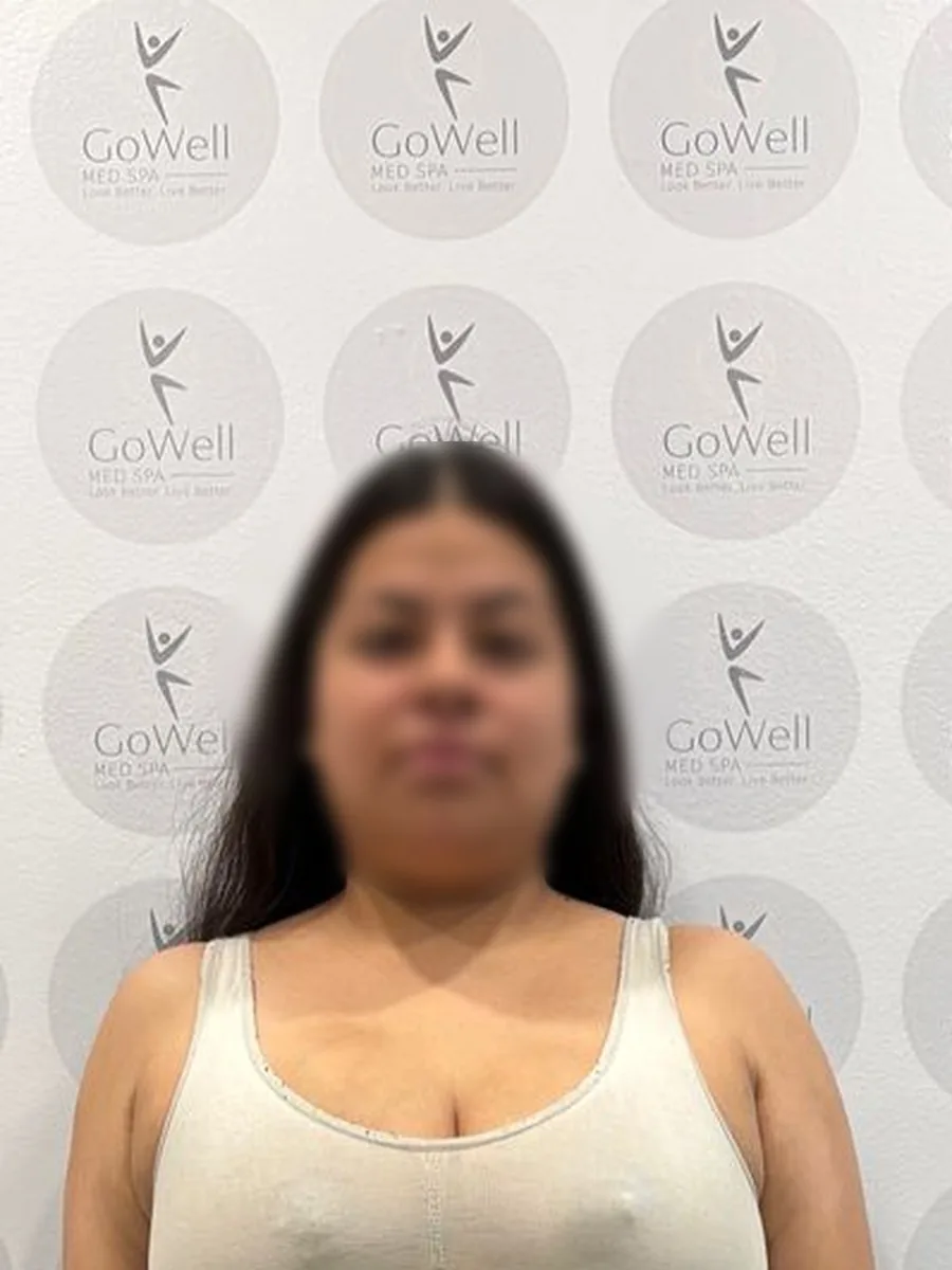 GoWell weight loss client, before – result 4