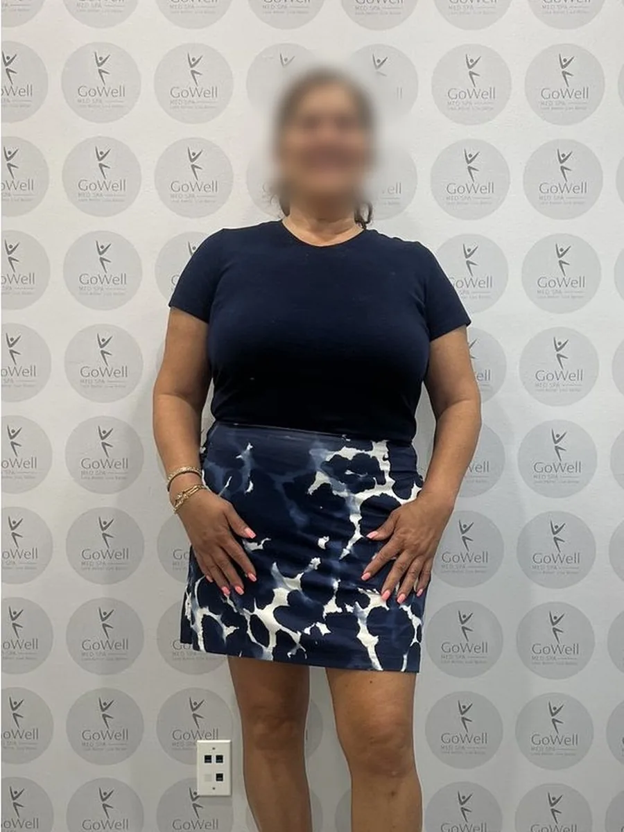 GoWell weight loss client, after – result 8