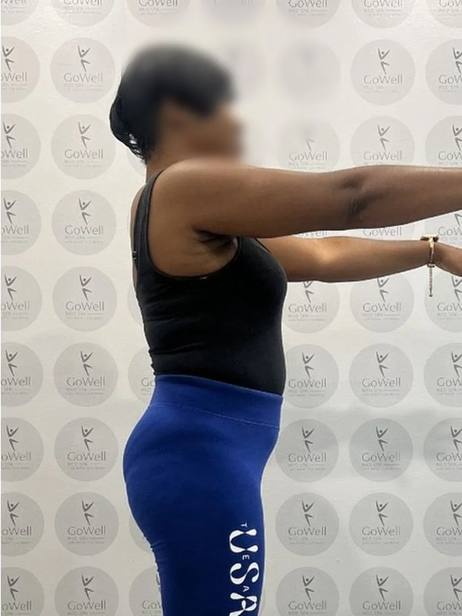 GoWell weight loss client, after – result 7