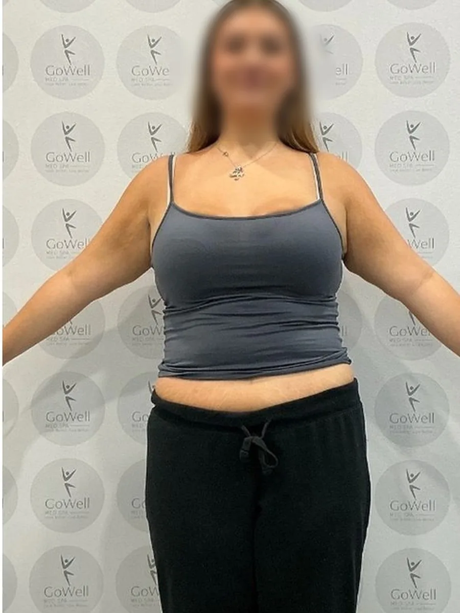 GoWell weight loss client, after – result 9