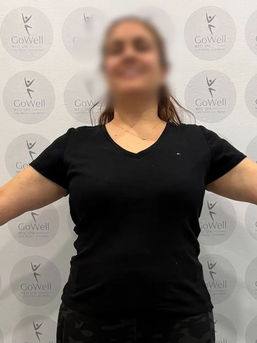 GoWell weight loss client, before – result 1