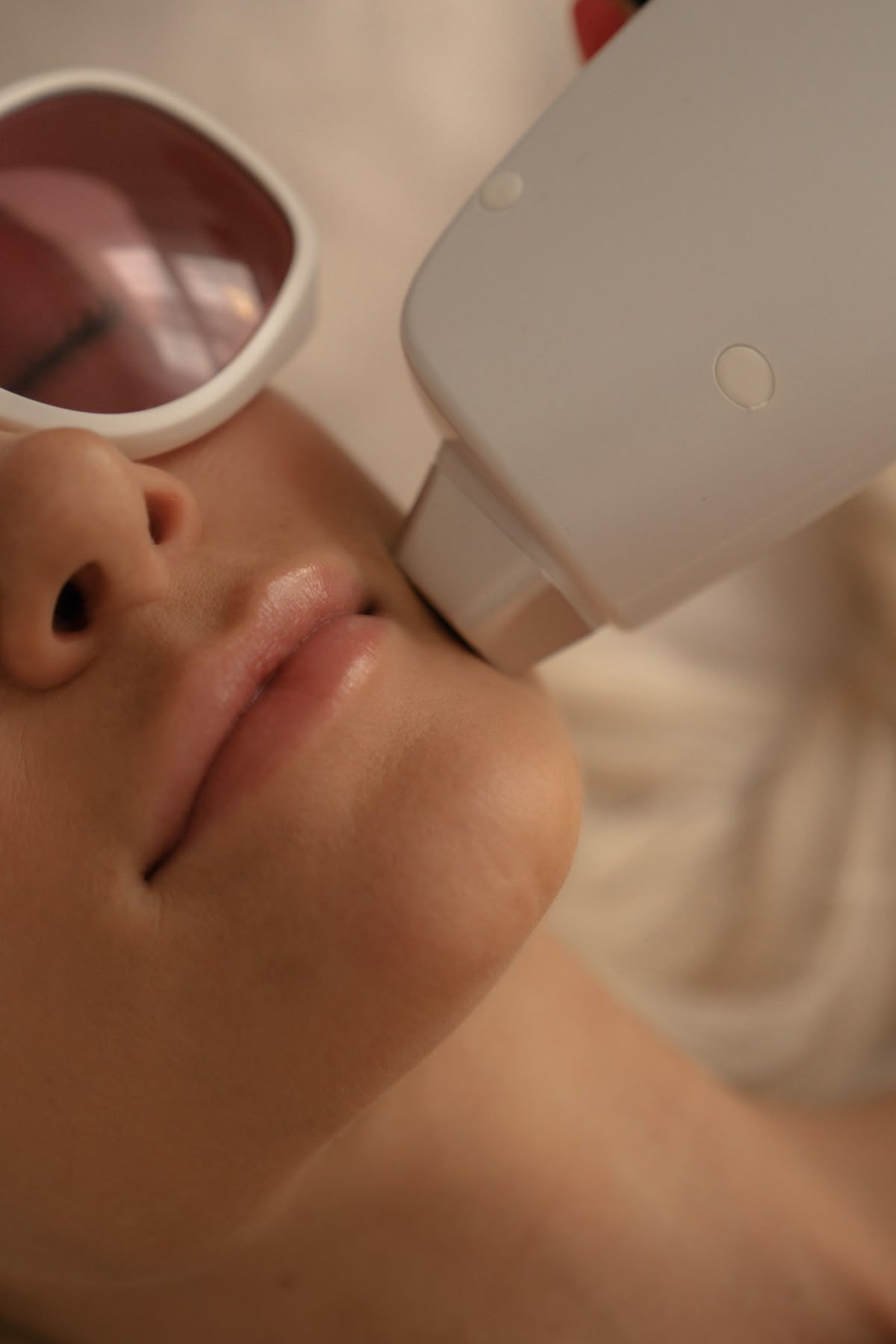 Laser Hair Removal